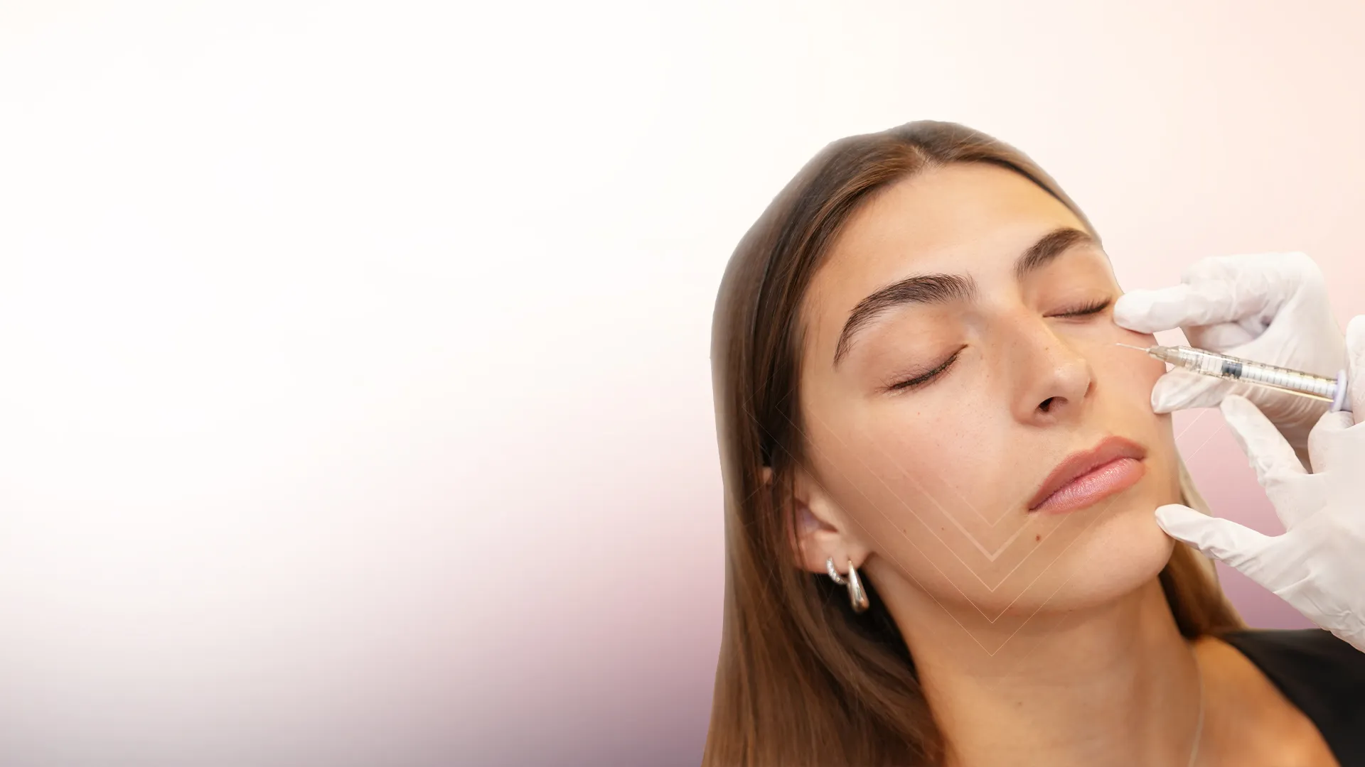 Teosyal & Hyaluronic Acid Dermal Fillers treatment at Toronto medical spa - Smooth Folds, Lift Hollow Areas & Enhance Facial Harmony...